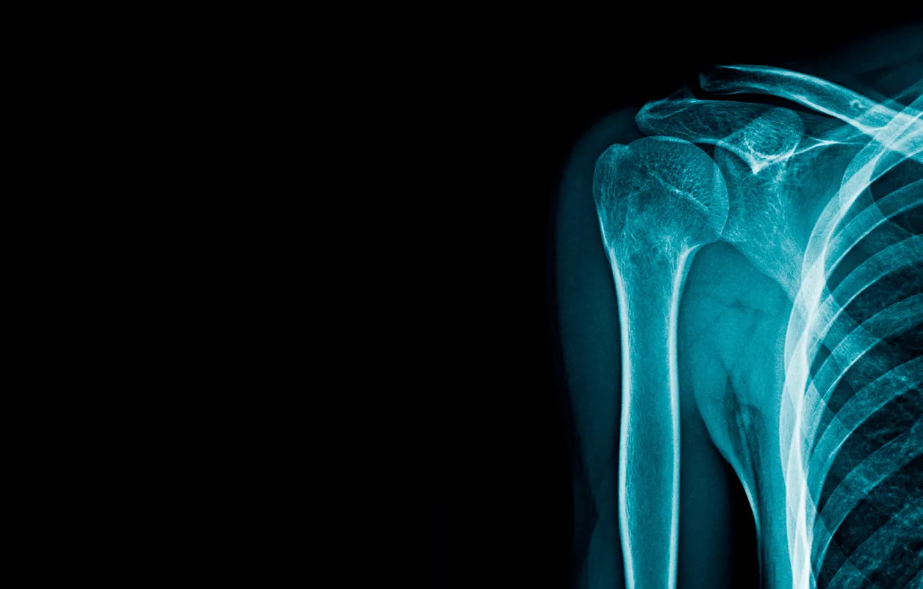 Wallpaper blue, bones, x-ray images for desktop, section минимализм -  download